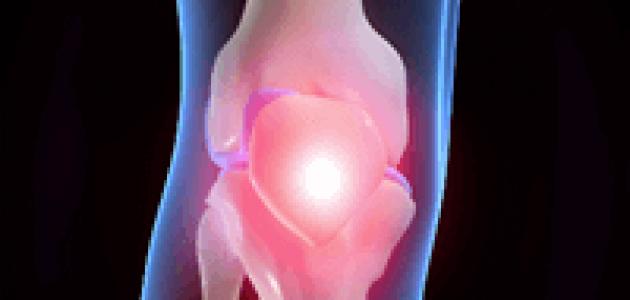 خشونة الركبة أعراضها وطرق علاجها
